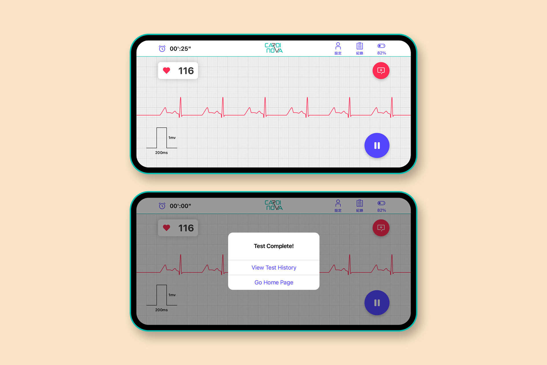 Cardinova ECG, UX/UI Design – Adolfo Monti