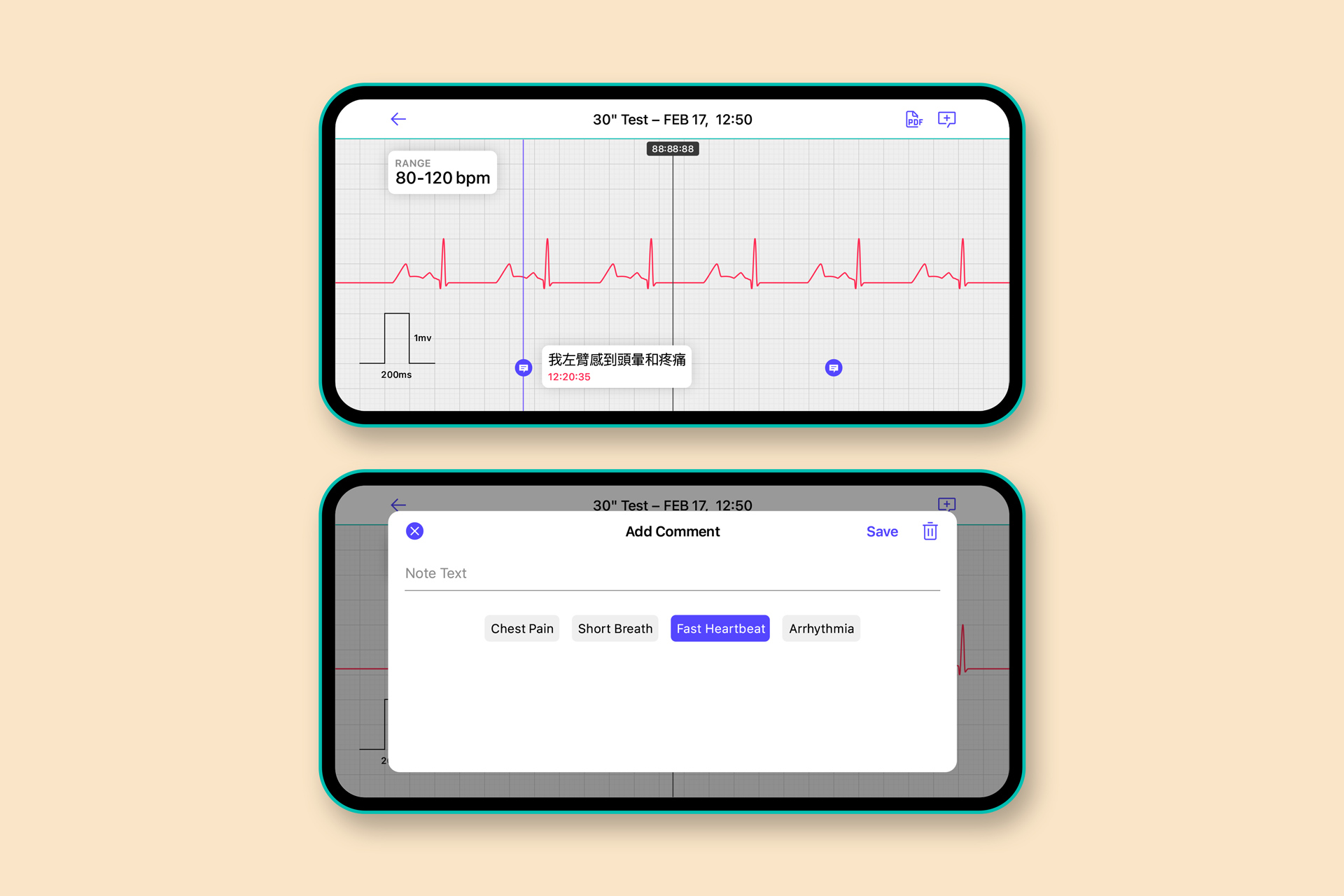 Cardinova ECG, UX/UI Design – Adolfo Monti