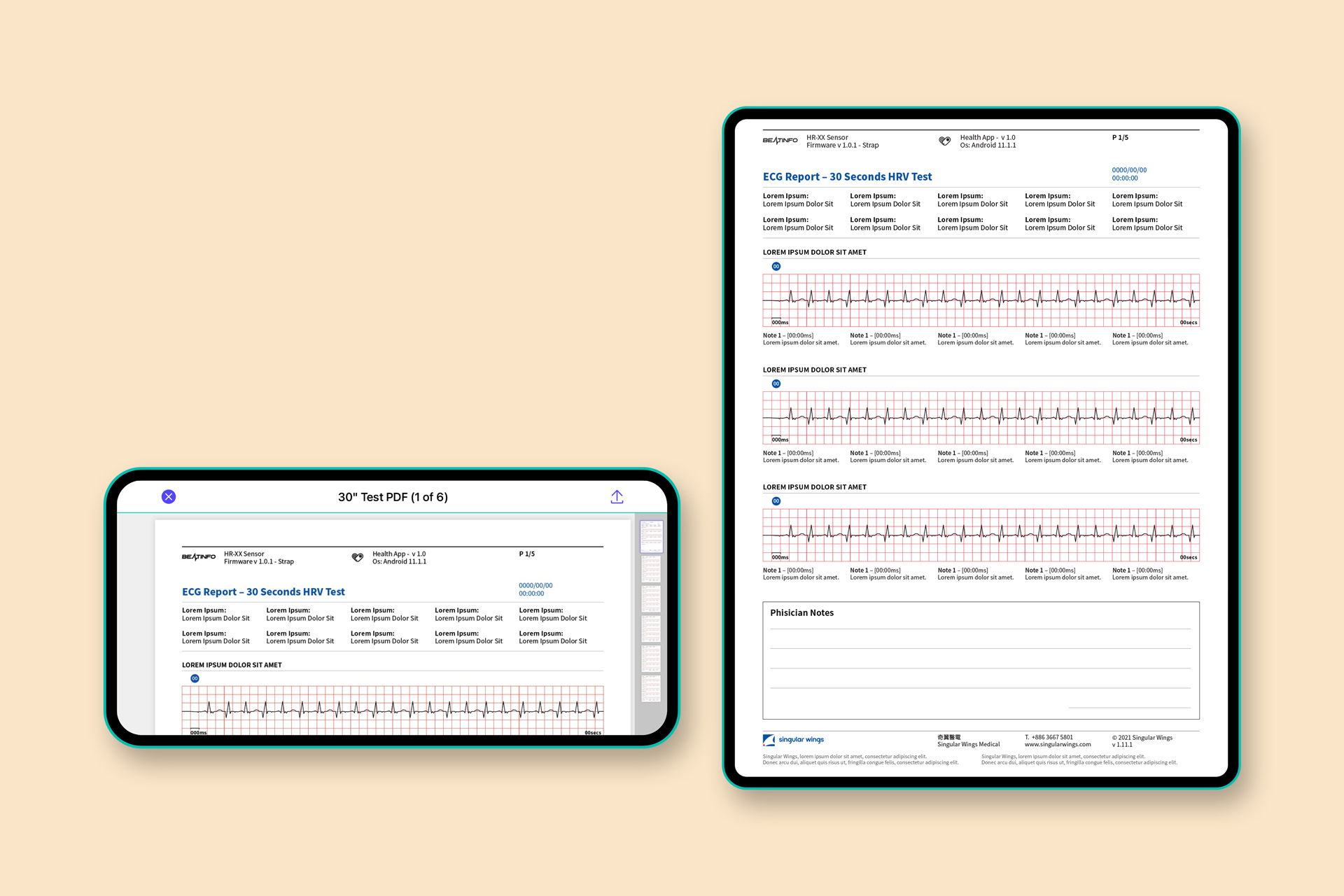 Cardinova ECG, UX/UI Design – Adolfo Monti